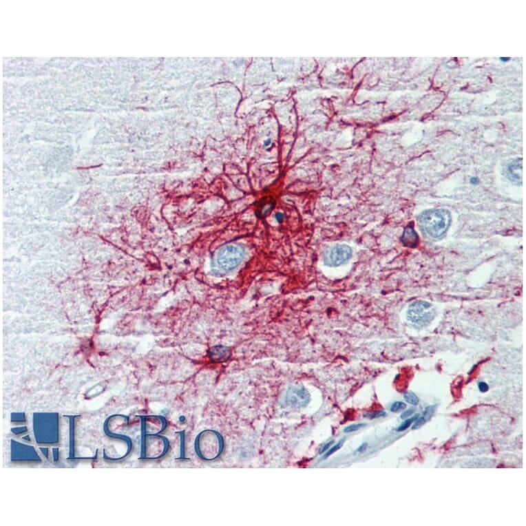 IHC - Anti-GFAP Antibody [GF-01] (A85506)