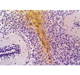 Immunohistochemistry - Anti-GFAP Antibody [GF-01] (A85506) - Antibodies.com