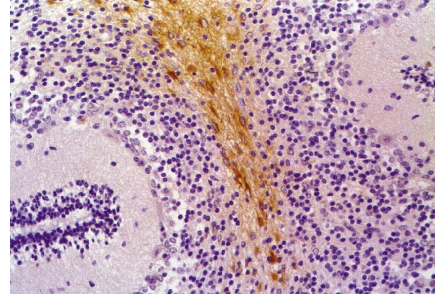 Immunohistochemistry - Anti-GFAP Antibody [GF-01] (A85506) - Antibodies.com