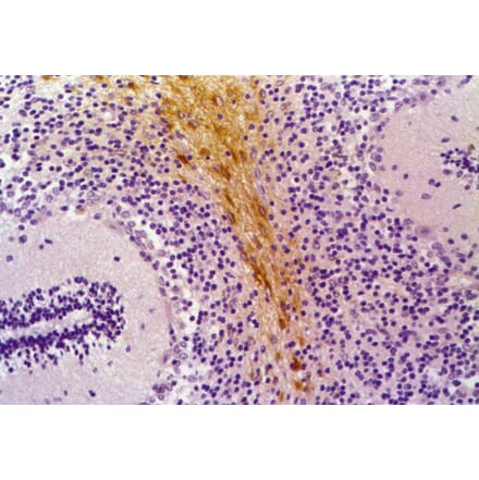 Immunohistochemistry - Anti-GFAP Antibody [GF-01] (A85506) - Antibodies.com
