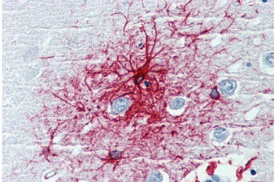 Immunohistochemistry - Anti-GFAP Antibody [GF-01] (A85505) - Antibodies.com