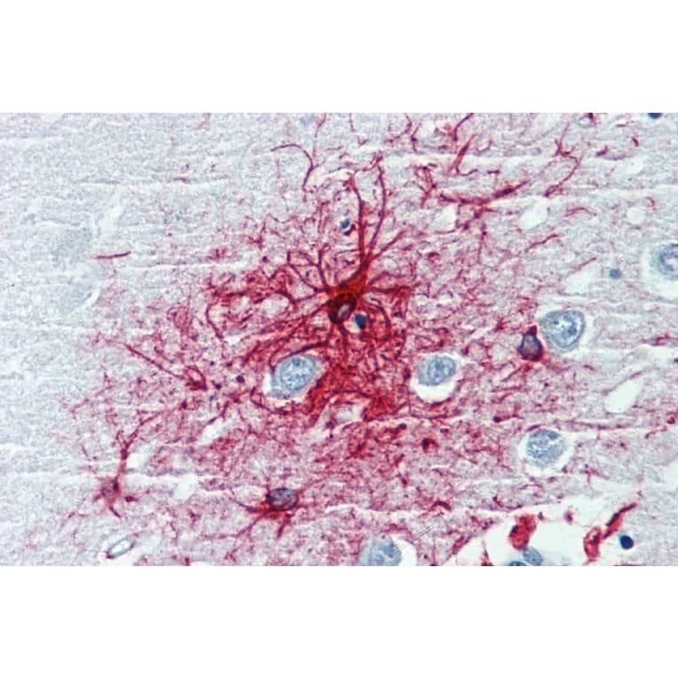 Immunohistochemistry - Anti-GFAP Antibody [GF-01] (A85505) - Antibodies.com