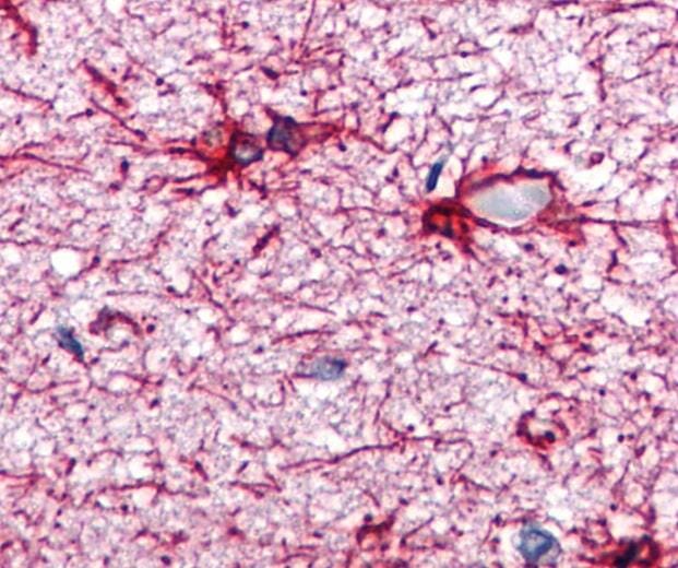 GFAP Antibodies | Antibodies.com