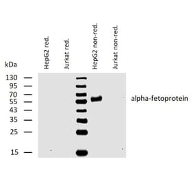 WB - Anti-alpha Fetoprotein Antibody [AFP-01] (A85533)