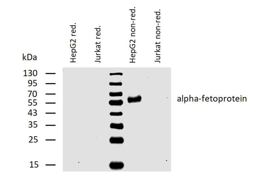 WB - Anti-alpha Fetoprotein Antibody [AFP-01] (A85533)
