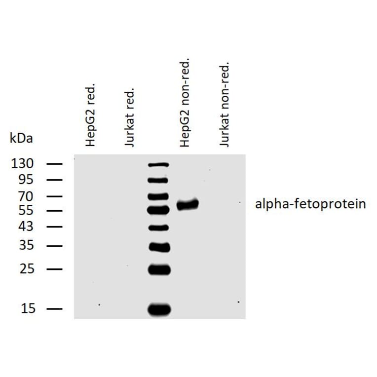 WB - Anti-alpha Fetoprotein Antibody [AFP-01] (A85533)