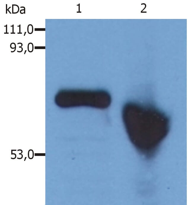 Western Blotting analysis of human alpha-Fetoprotein in Hep G2 human hepatocellular carcinoma cell line. Lane 1: Immunostaining with Anti-alpha Fetoprotein Antibody (A85533) (reducing conditions). Lane 2: Immunostaining with Anti-alpha Fetoprotein Antibody (A85533) (non-reducing conditions).