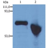 Western Blot - Anti-alpha Fetoprotein Antibody [AFP-01] (A85532) - Antibodies.com