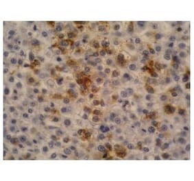 IHC - Anti-alpha Fetoprotein Antibody [AFP-11] (A85534)