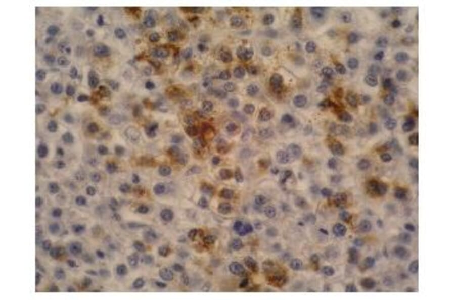 IHC - Anti-alpha Fetoprotein Antibody [AFP-11] (A85534)