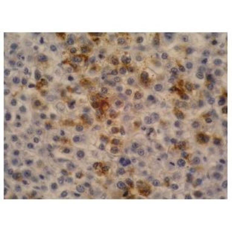 IHC - Anti-alpha Fetoprotein Antibody [AFP-11] (A85534)