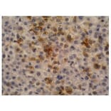 IHC - Anti-alpha Fetoprotein Antibody [AFP-11] (A85534)