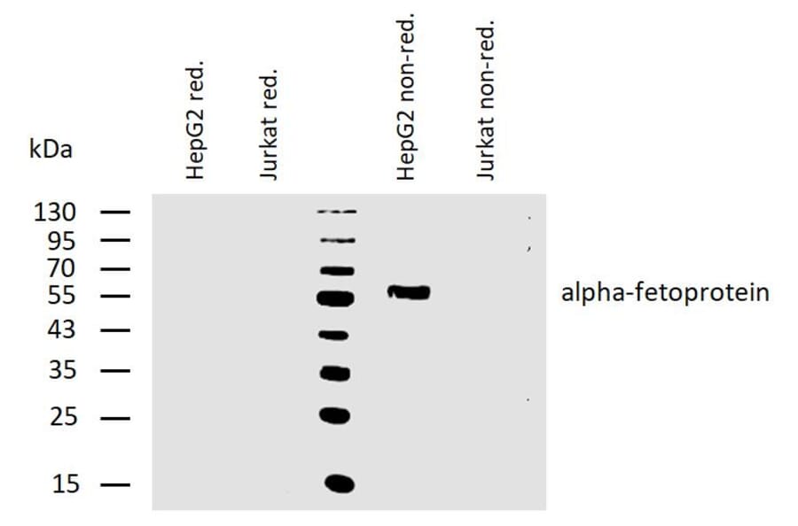 WB - Anti-alpha Fetoprotein Antibody [AFP-11] (A85534)