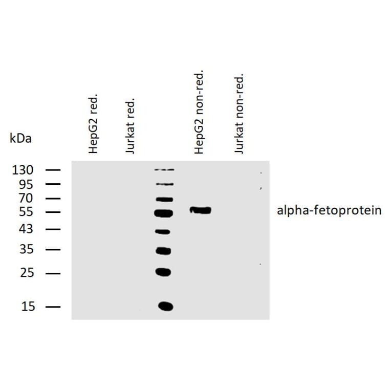 WB - Anti-alpha Fetoprotein Antibody [AFP-11] (A85534)