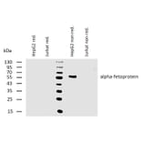 WB - Anti-alpha Fetoprotein Antibody [AFP-11] (A85534)