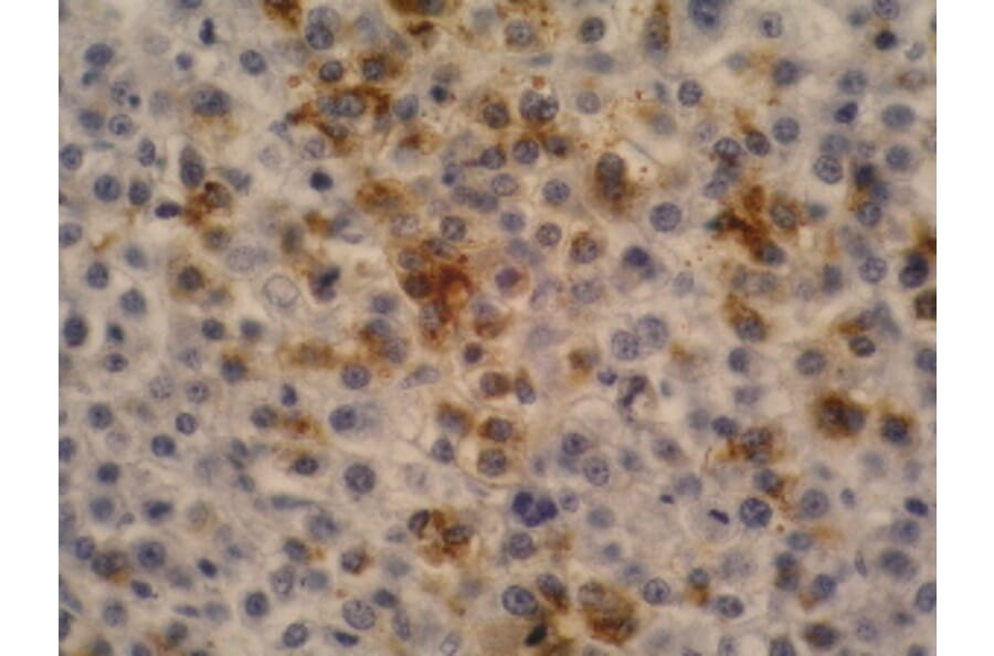Immunohistochemistry - Anti-alpha Fetoprotein Antibody [AFP-11] (A85533) - Antibodies.com