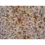 Immunohistochemistry - Anti-alpha Fetoprotein Antibody [AFP-11] (A85533) - Antibodies.com