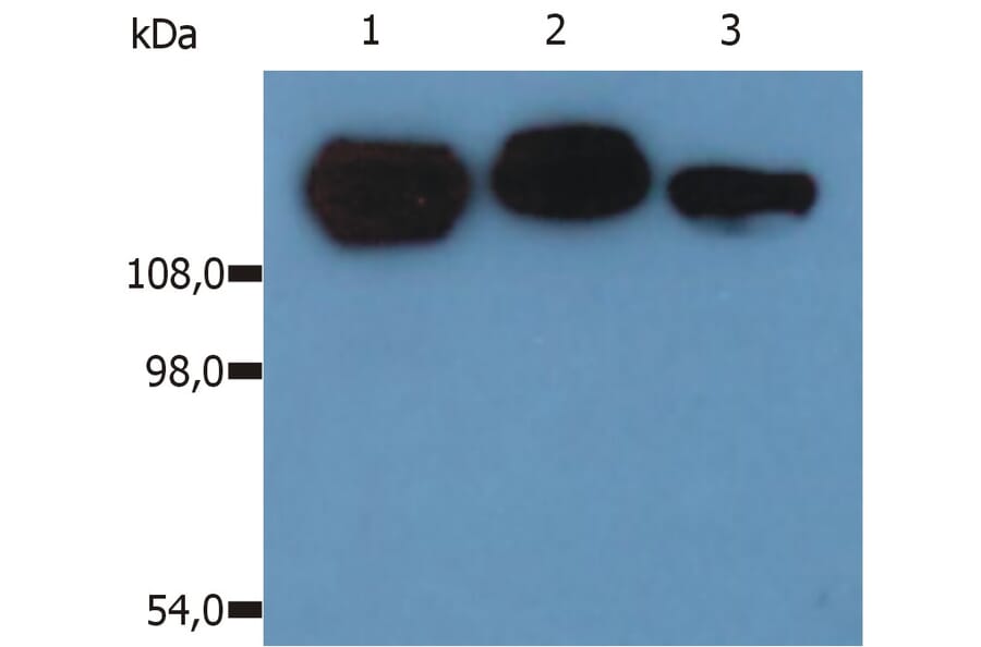Western Blot - Anti-Integrin beta 1 Antibody [MEM-101A] (A85540) - Antibodies.com