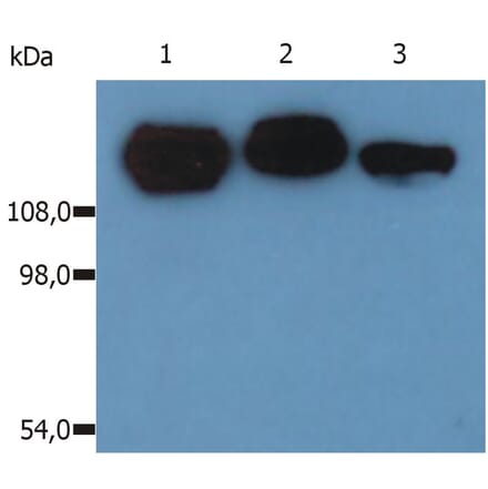 Western Blot - Anti-Integrin beta 1 Antibody [MEM-101A] (A85540) - Antibodies.com