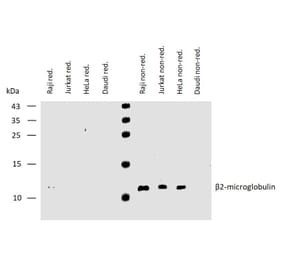 WB - Anti-beta 2 Microglobulin Antibody [B2M-01] (A85545)
