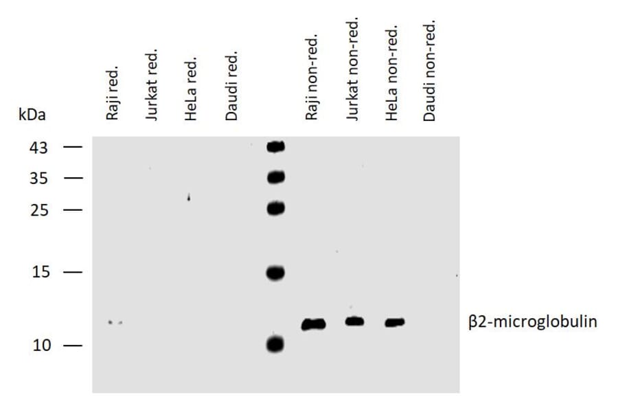 WB - Anti-beta 2 Microglobulin Antibody [B2M-01] (A85545)