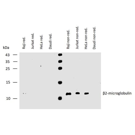 WB - Anti-beta 2 Microglobulin Antibody [B2M-01] (A85545)