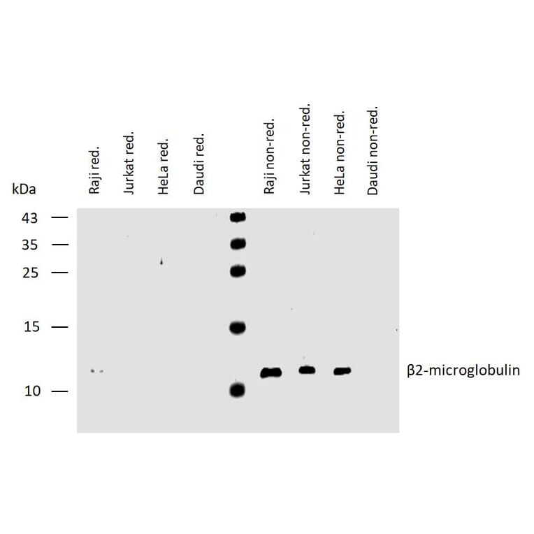 WB - Anti-beta 2 Microglobulin Antibody [B2M-01] (A85545)