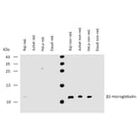 WB - Anti-beta 2 Microglobulin Antibody [B2M-01] (A85545)