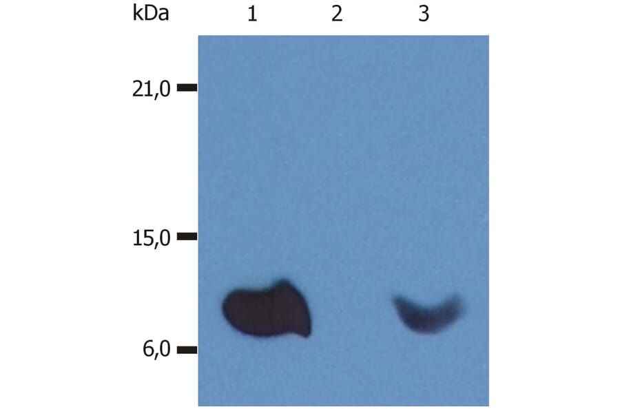 WB - Anti-beta 2 Microglobulin Antibody [B2M-01] (A85545)
