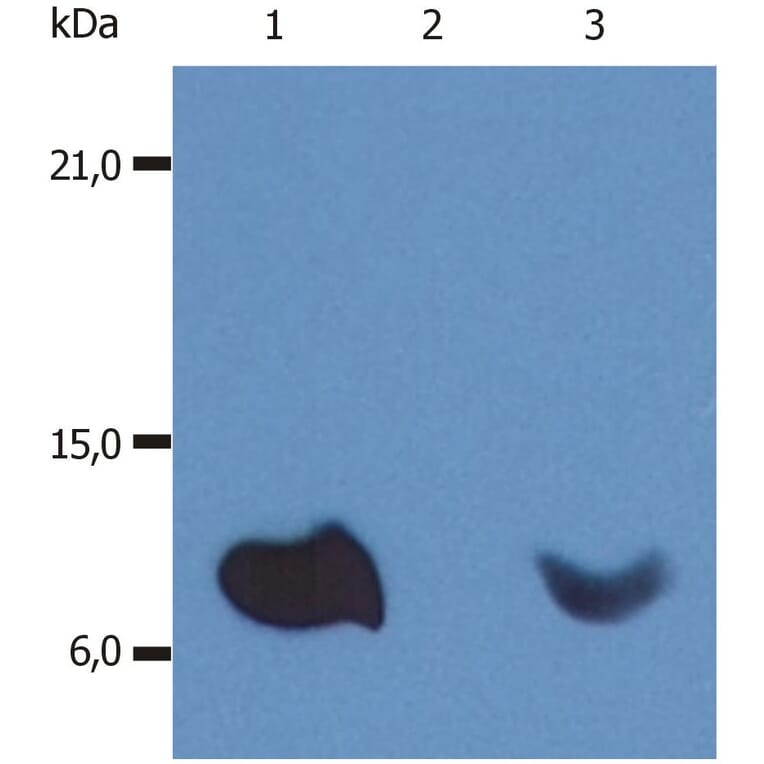 WB - Anti-beta 2 Microglobulin Antibody [B2M-01] (A85545)