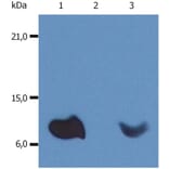 WB - Anti-beta 2 Microglobulin Antibody [B2M-01] (A85545)