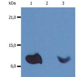 Western Blot - Anti-beta 2 Microglobulin Antibody [B2M-01] (A85544) - Antibodies.com