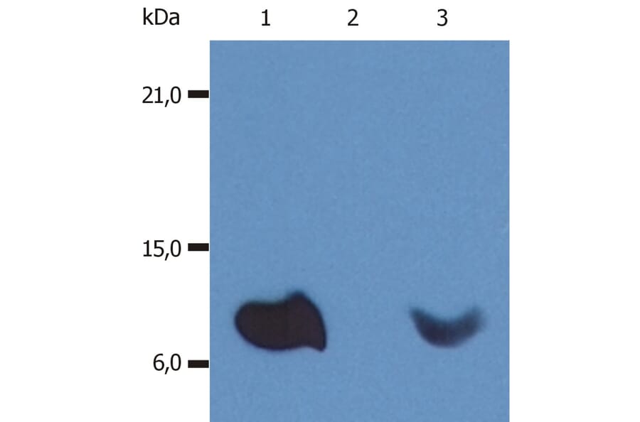 Western Blot - Anti-beta 2 Microglobulin Antibody [B2M-01] (A85544) - Antibodies.com