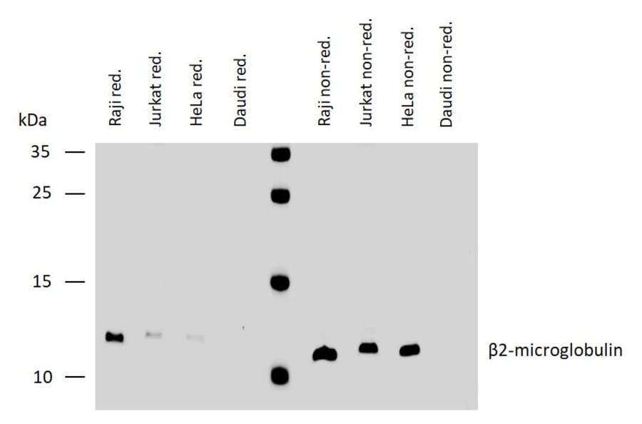 WB - Anti-beta 2 Microglobulin Antibody [B2M-02] (A85546)