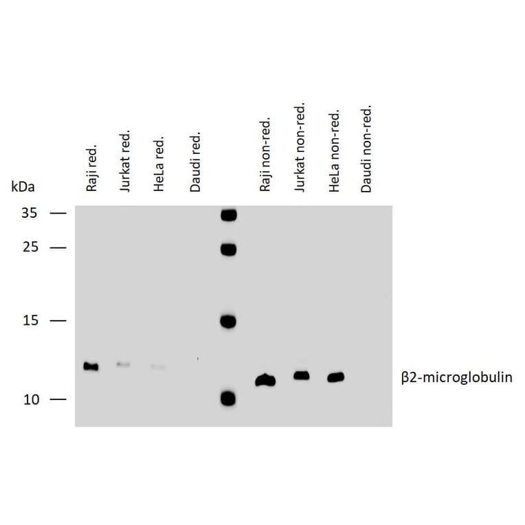 WB - Anti-beta 2 Microglobulin Antibody [B2M-02] (A85546)