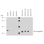 WB - Anti-beta 2 Microglobulin Antibody [B2M-02] (A85546)
