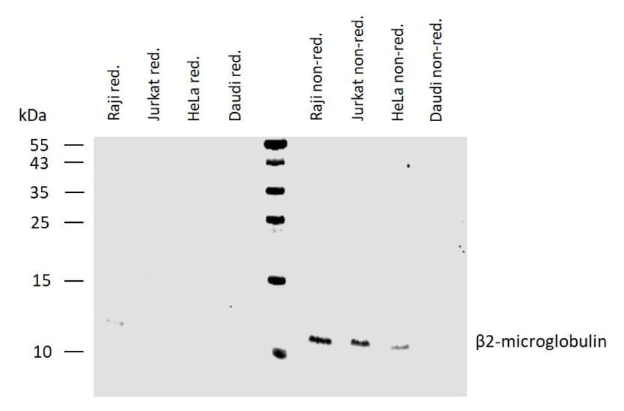 WB - Anti-beta 2 Microglobulin Antibody [B2M-01] (Biotin) (A85547)