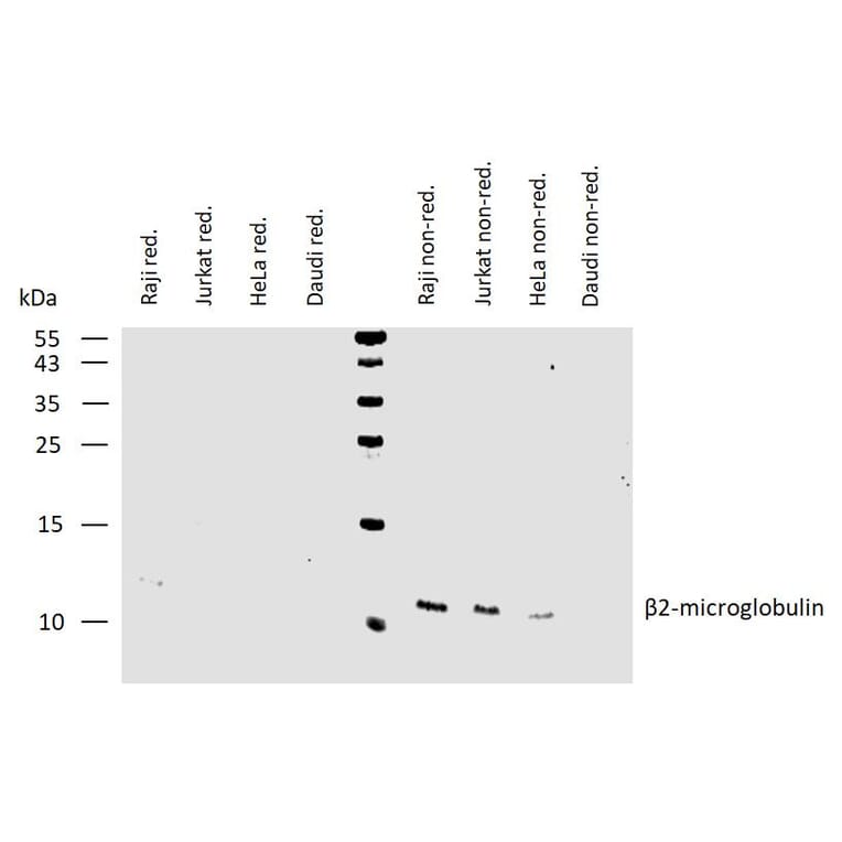 WB - Anti-beta 2 Microglobulin Antibody [B2M-01] (Biotin) (A85547)