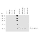 WB - Anti-beta 2 Microglobulin Antibody [B2M-01] (Biotin) (A85547)