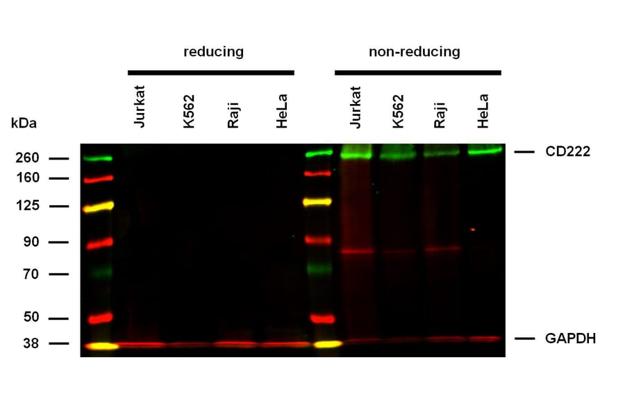 WB - Anti-CD222 Antibody [MEM-238] (A85553)