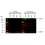 WB - Anti-CD222 Antibody [MEM-238] (A85553)