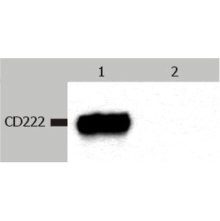 Western Blot - Anti-CD222 Antibody [MEM-238] (A85552) - Antibodies.com