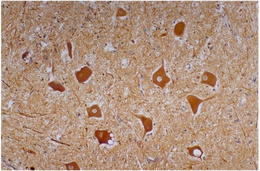 IHC - Anti-Neurofilament H Antibody [NF-01] (A85597)