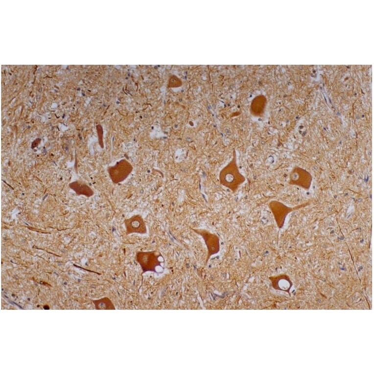 IHC - Anti-Neurofilament H Antibody [NF-01] (A85597)