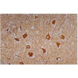 IHC - Anti-Neurofilament H Antibody [NF-01] (A85597)
