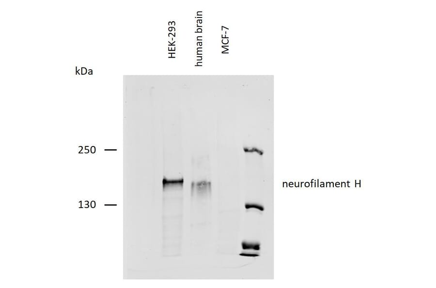 WB - Anti-Neurofilament H Antibody [NF-01] (A85597)