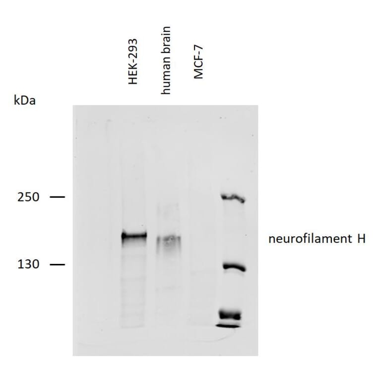 WB - Anti-Neurofilament H Antibody [NF-01] (A85597)