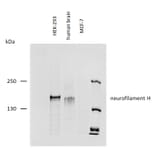 WB - Anti-Neurofilament H Antibody [NF-01] (A85597)