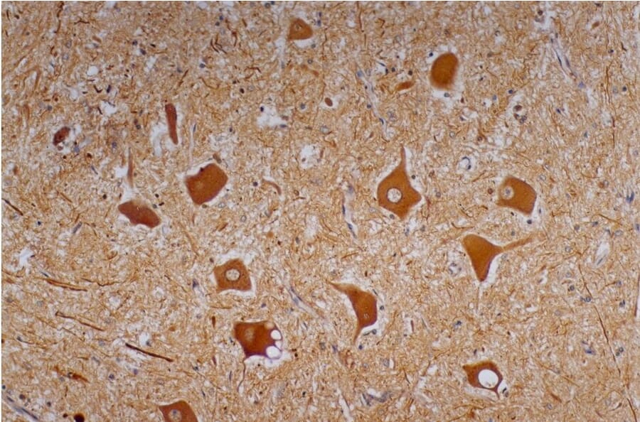 Immunohistochemistry - Anti-Neurofilament H Antibody [NF-01] (A85596) - Antibodies.com