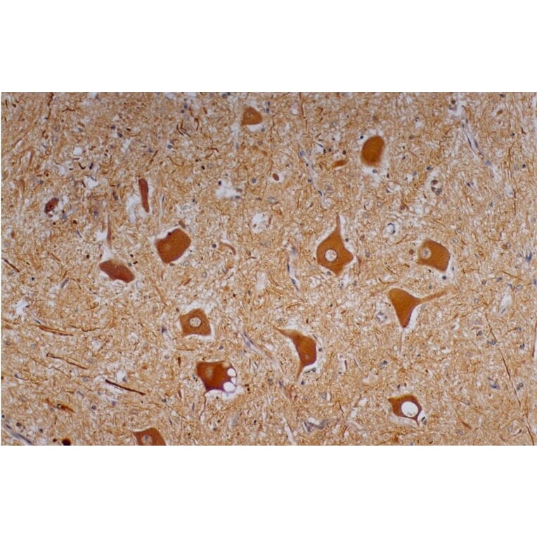 Immunohistochemistry - Anti-Neurofilament H Antibody [NF-01] (A85596) - Antibodies.com